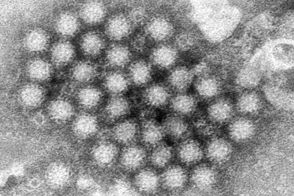 Norovirus Outbreaks Surge Across the U.S., Health Officials Warn of Rising Cases